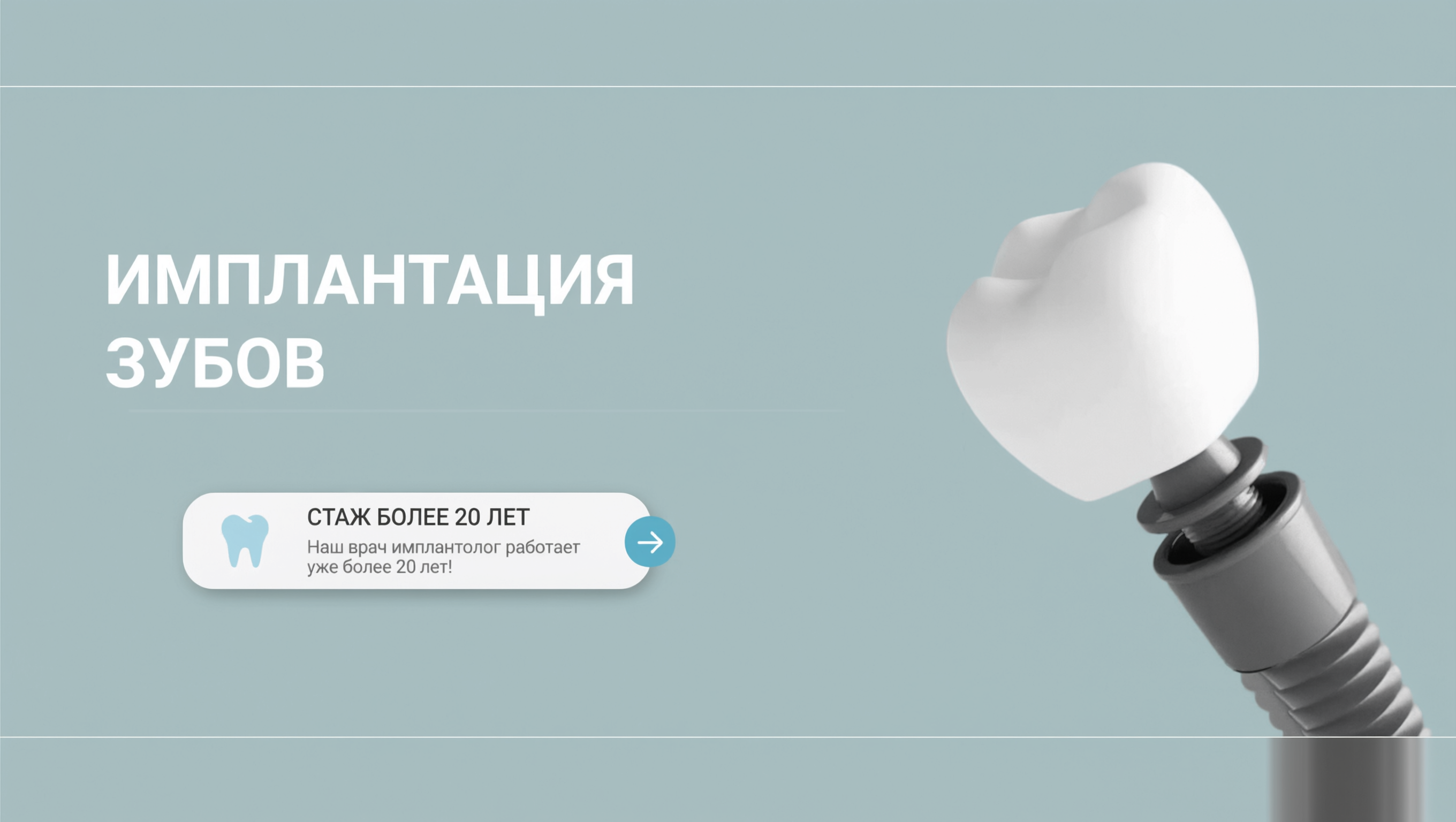Имплантация зубов, имплантат Ю. Корея — 20 900 ₽